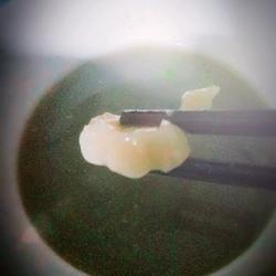 啤酒麦几（面疙瘩）的做法[图]